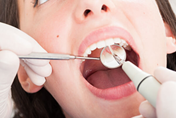 現状の説明・治療計画のご提案、歯周病検査・基本治療