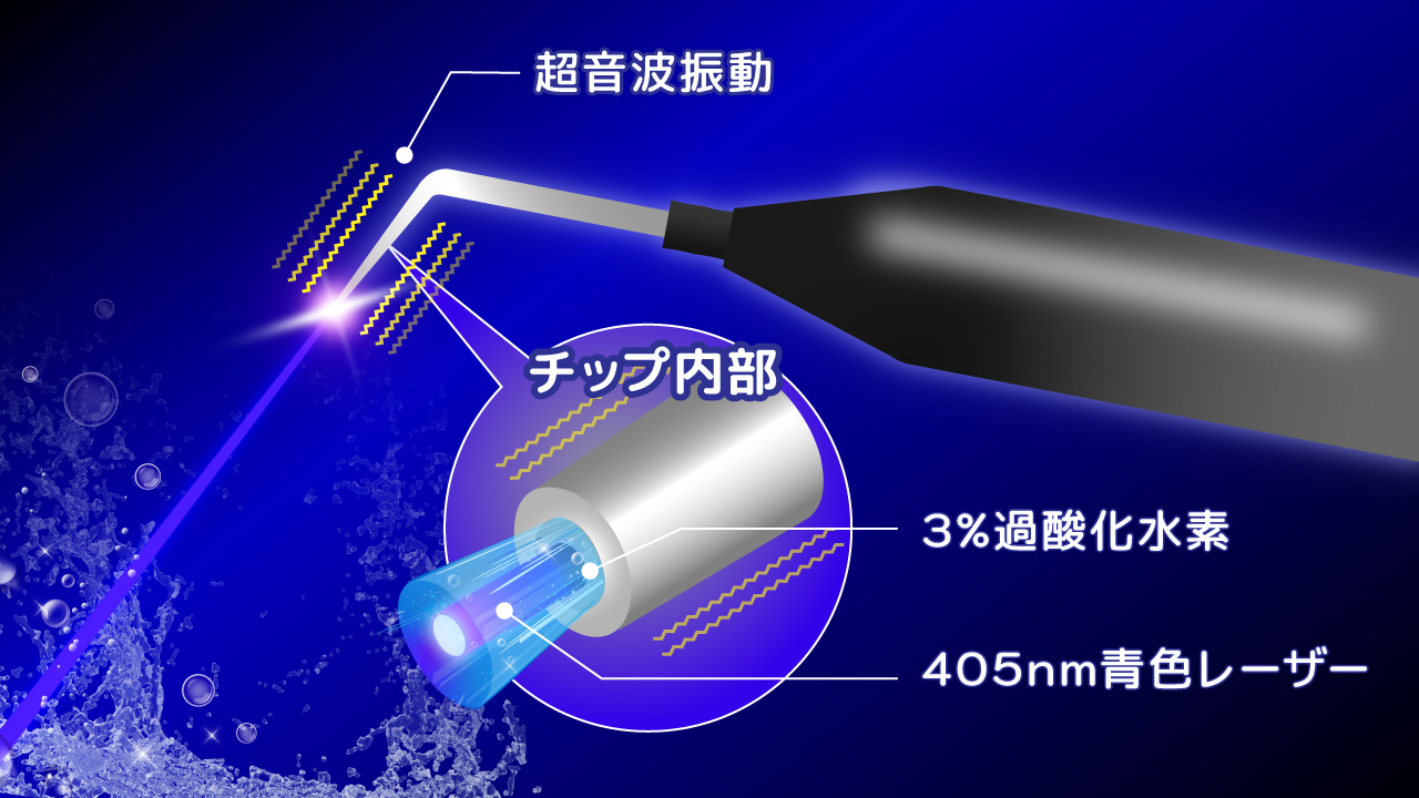 外科処置なしで深部を殺菌